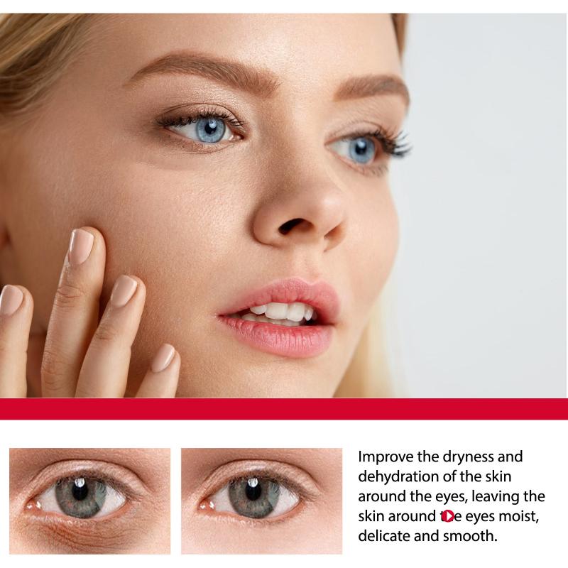 Women Bags Under Eyes - كريم عيون مضاد للشيخوخة بالريتينول لعلاج