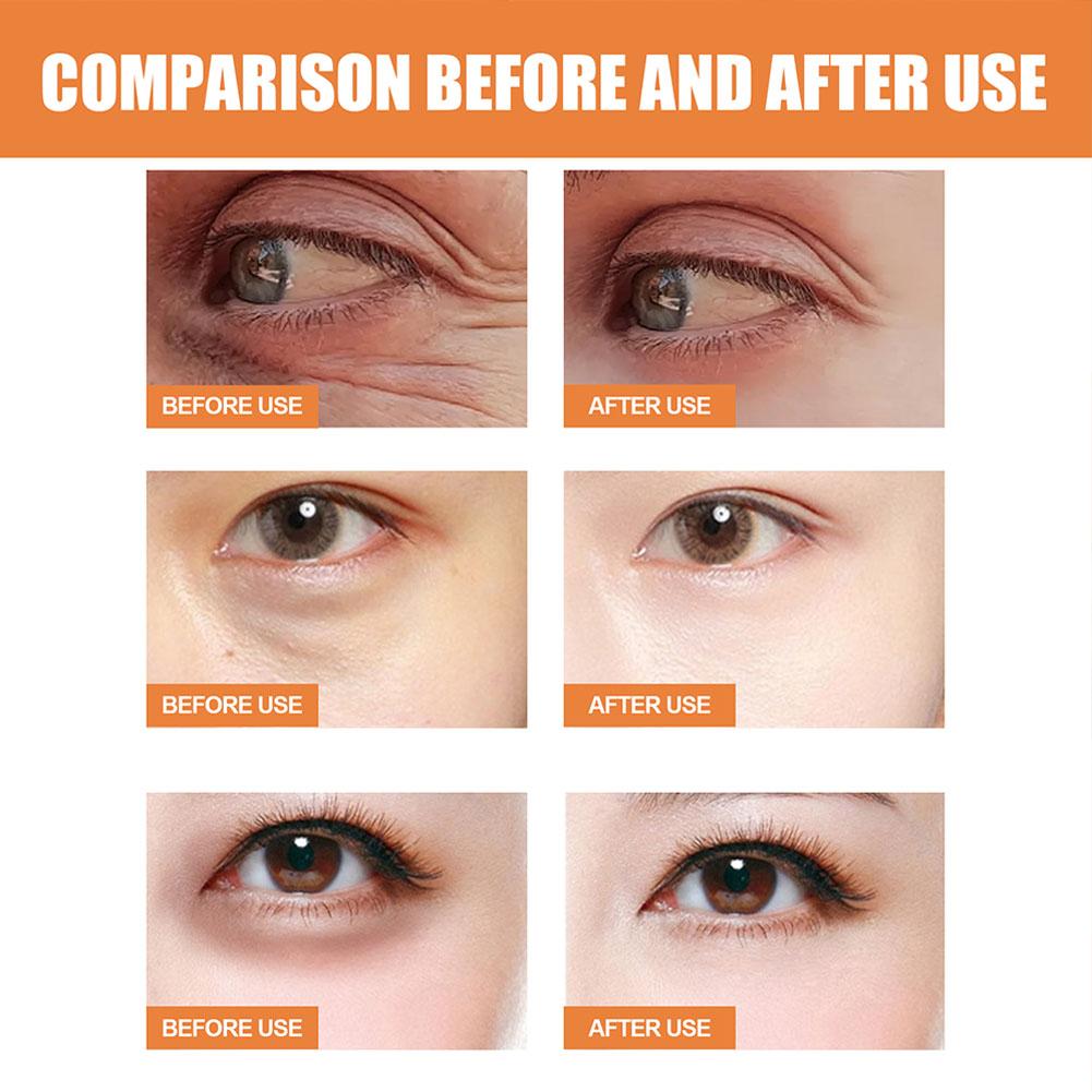 بلسم فيتامين سي للعين: يقلل من - مراجعة Women Bags Under Eyes وسعره